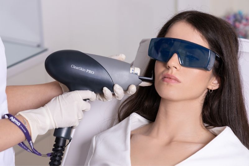Alma ClearSkin Pro