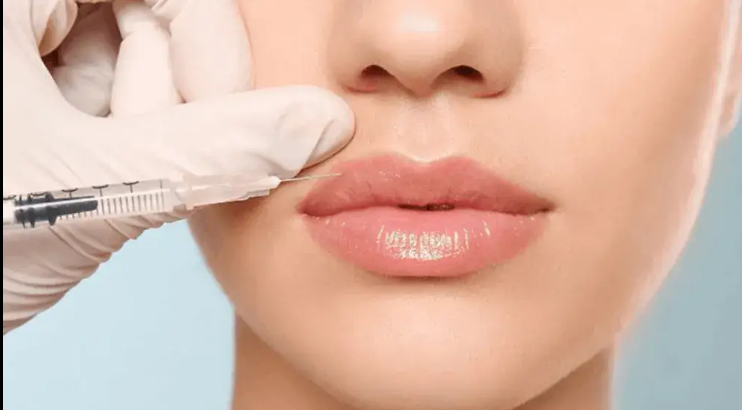 Dermal Filler